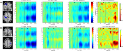 Time frequency plots and statistics for EEG data